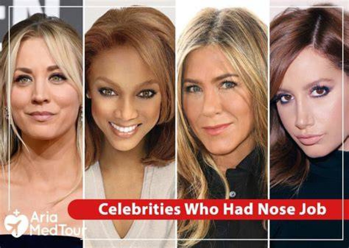 11 Celebrities Who Got Nose Jobs, from Khloe Kardashian and Iggy Azalea’s Proud Rhinoplasty to Tyra Banks and Real Housewife Teresa Giudice – but Bella Hadid ‘Regrets’ It