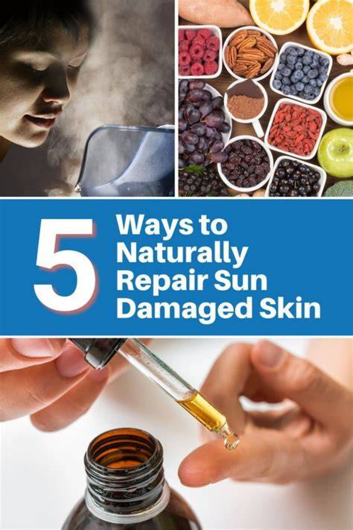 5 Beauty Treatments to Repair Sun-Damaged Skin, from Microneedling to Cryotherapy