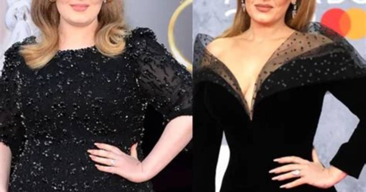 Adele’s Plastic Surgery: Exploring the Story Behind the Rumors