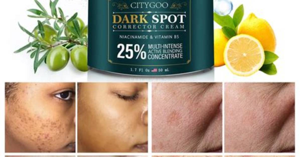 Best Dark Spot Removal Cream: Your Ultimate Guide to Radiant Skin