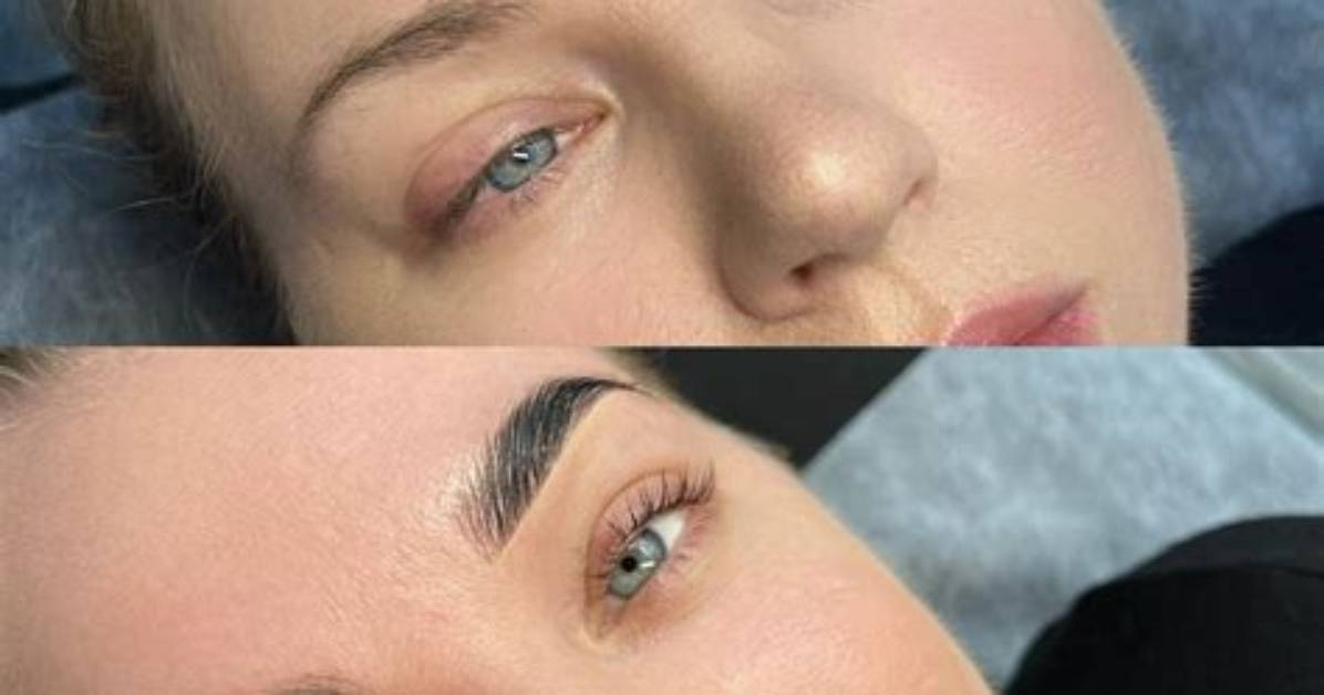 Brow Lamination Before and After: See the Dramatic Improvements