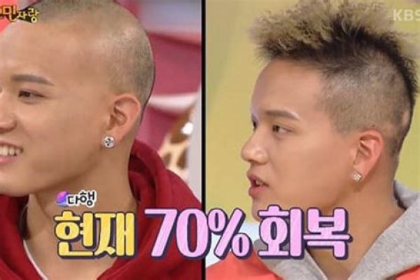 Btob’s Peniel Gives Update on His Struggle with Hair Loss - Hot off the Press: Soompi News!