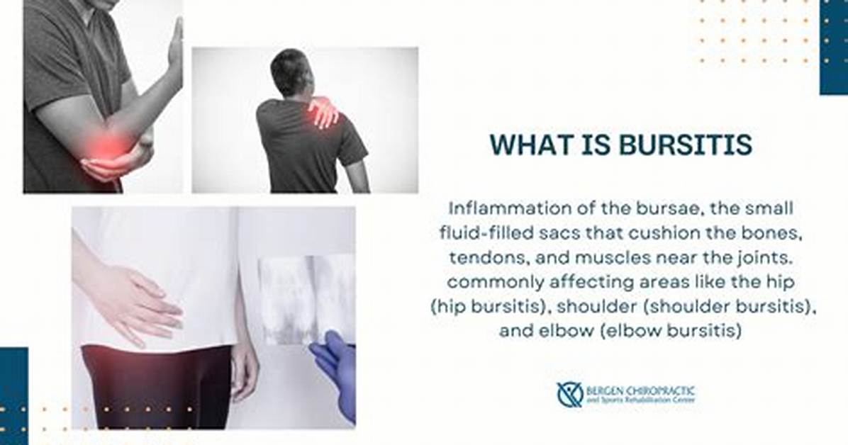 Can a Chiropractor Help Hip Bursitis?