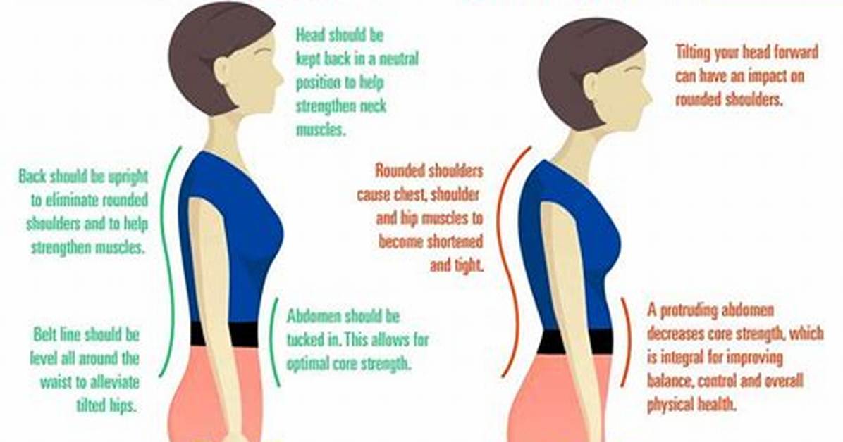 Can a Chiropractor Help with Rounded Shoulders?