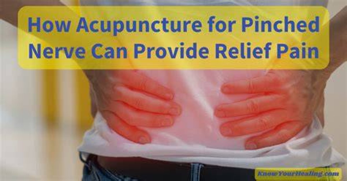 Can Acupuncture Fix a Pinched Nerve?