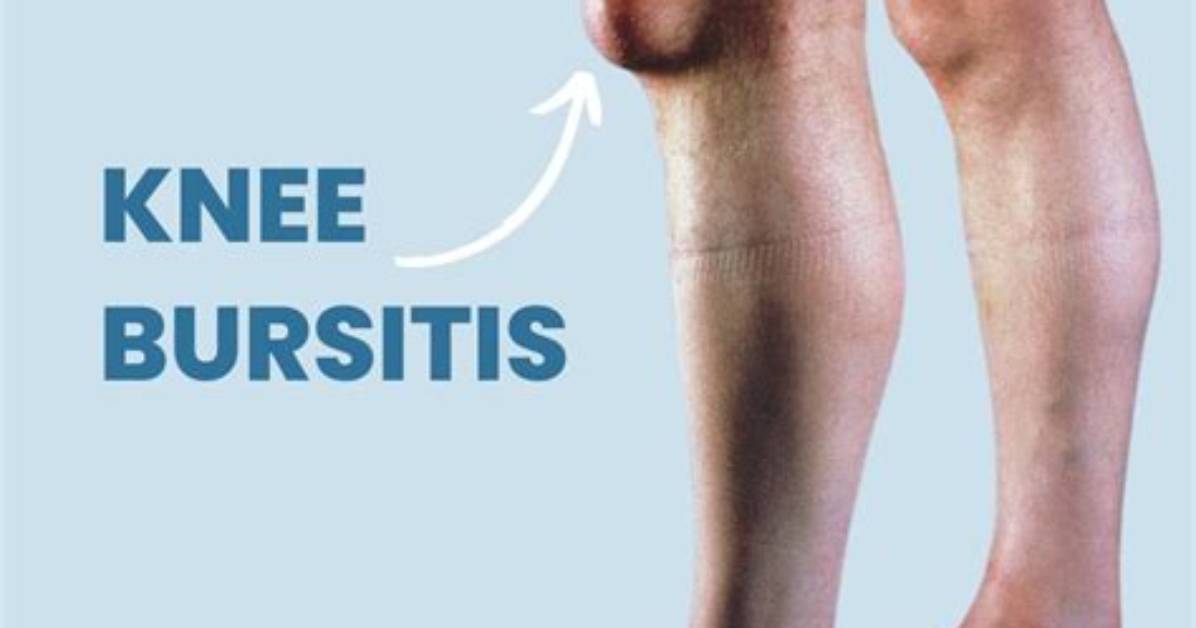 Can Bursitis Cripple You?