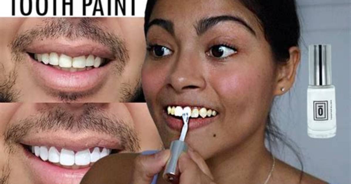 Can Dentist Paint Teeth White?