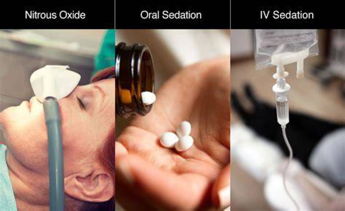 Can You Sleep During Iv Sedation?