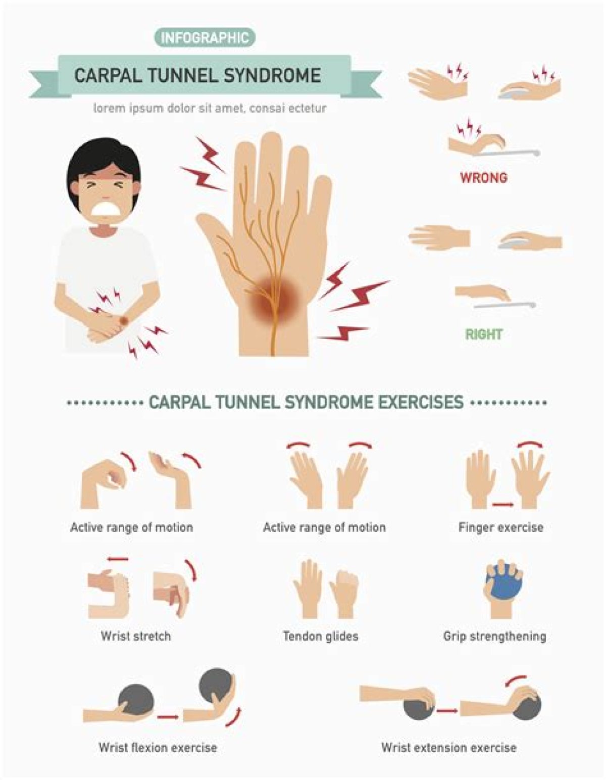 Carpal Tunnel Syndrome Self-Care: Relief Without Surgery