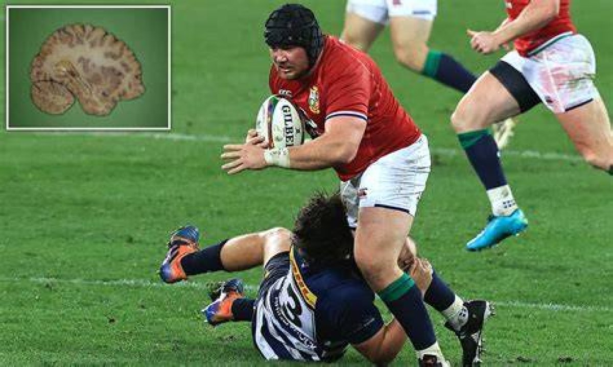 Do Rugby Players Have to Be Tall?