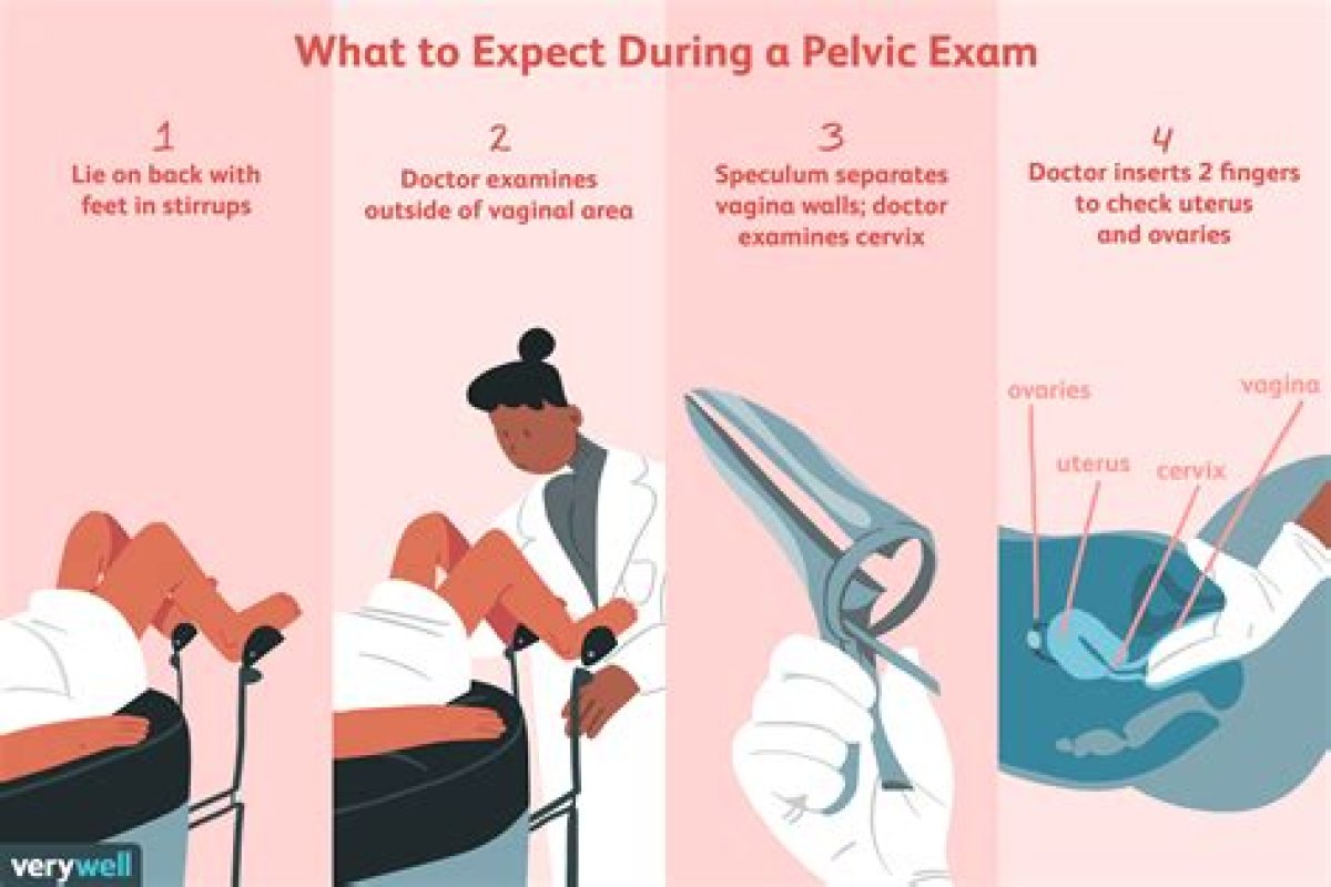 Do Women Need an Annual Pelvic Exam?