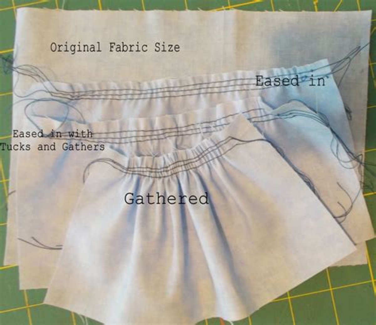 Doctors Sewed Me up Too Tight After My Episiotomy