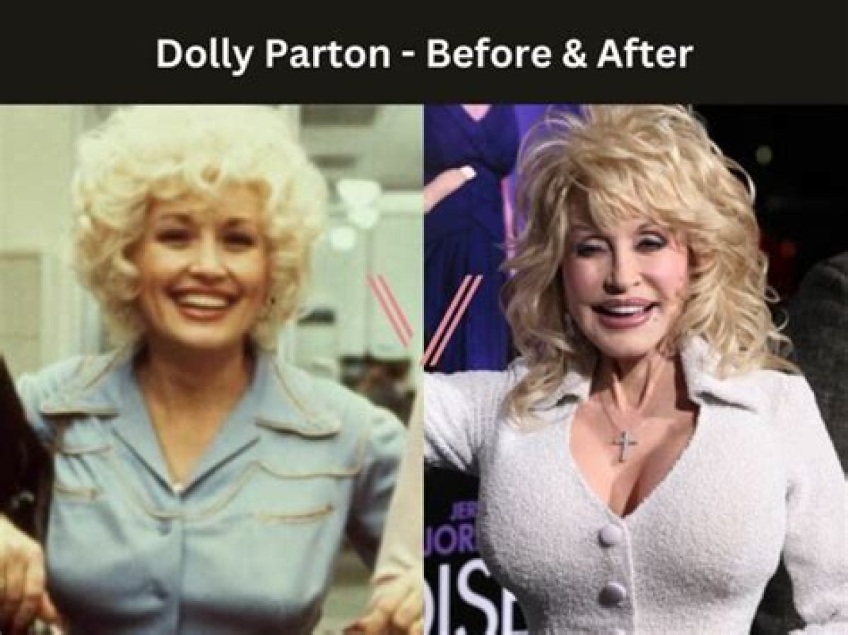 Does Dolly Parton Have Breast Implants and Did She Get Them Insured?