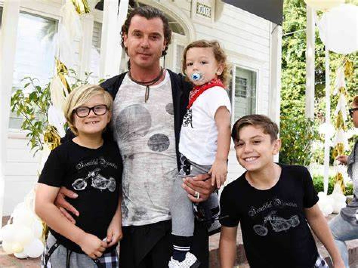 Exploring the Mystique of Gavin Rossdale's Plastic Surgery Journey