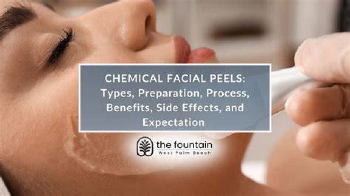 Facial Peels 101: Are Chemical Peels Really Good for the Skin? Whether Done at Home with Beauty Products or Professionally, the Treatment Boasts a Range of Benefits, from Aesthetic to Medical