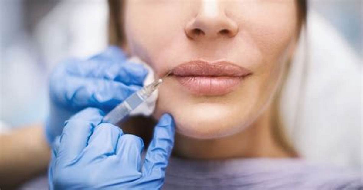 How Labial Fillers Can Boost Women’s Sexual Confidence, Especially After Menopause