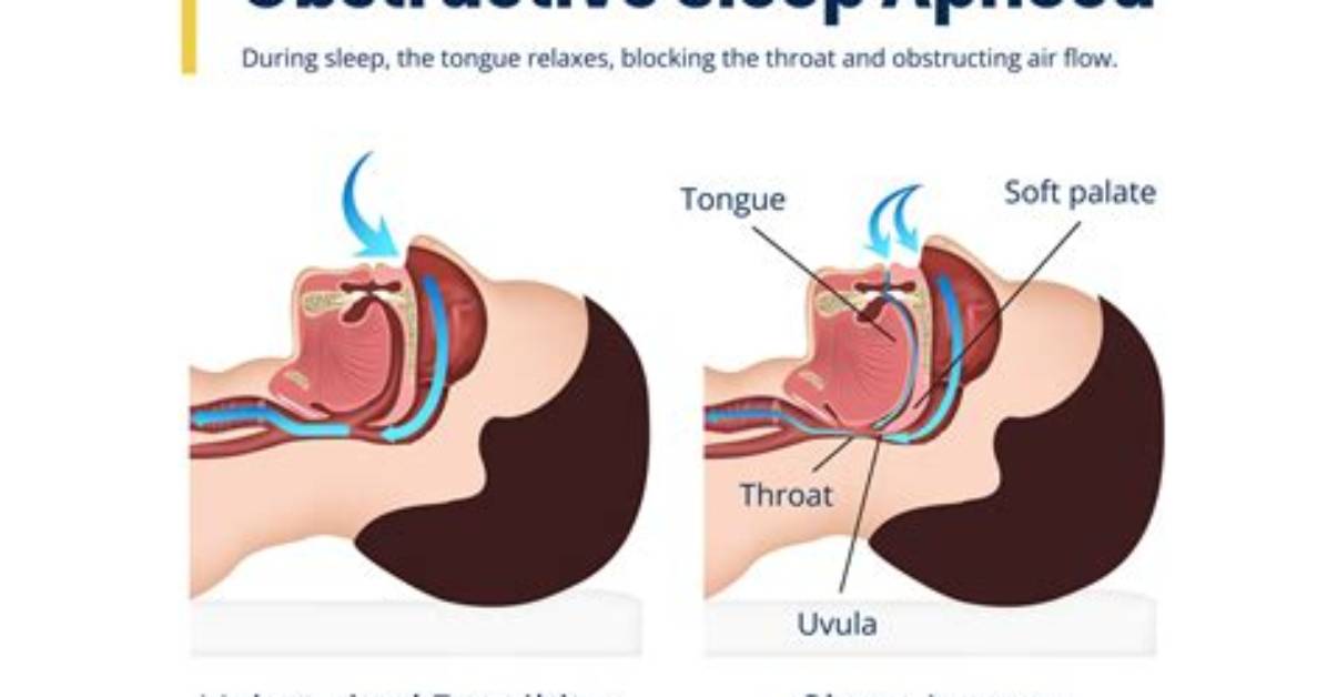 How Sleep Apnoea Treatment Cured a Father’s Breathing Problems, Giving Him an Energy Boost and Helping Him Lose 15Kg