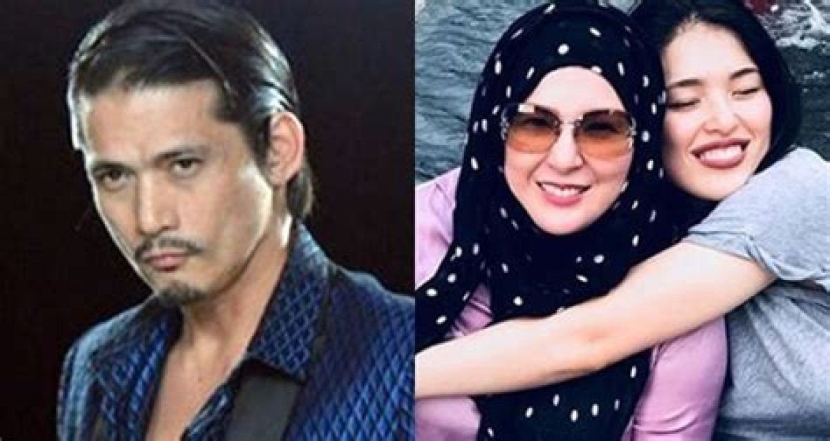 In Philippines, Robin Padilla’s Wife Mariel’s ‘Gluta Drips’ Scandal Spotlights Deadly Skin-Whitening Treatment