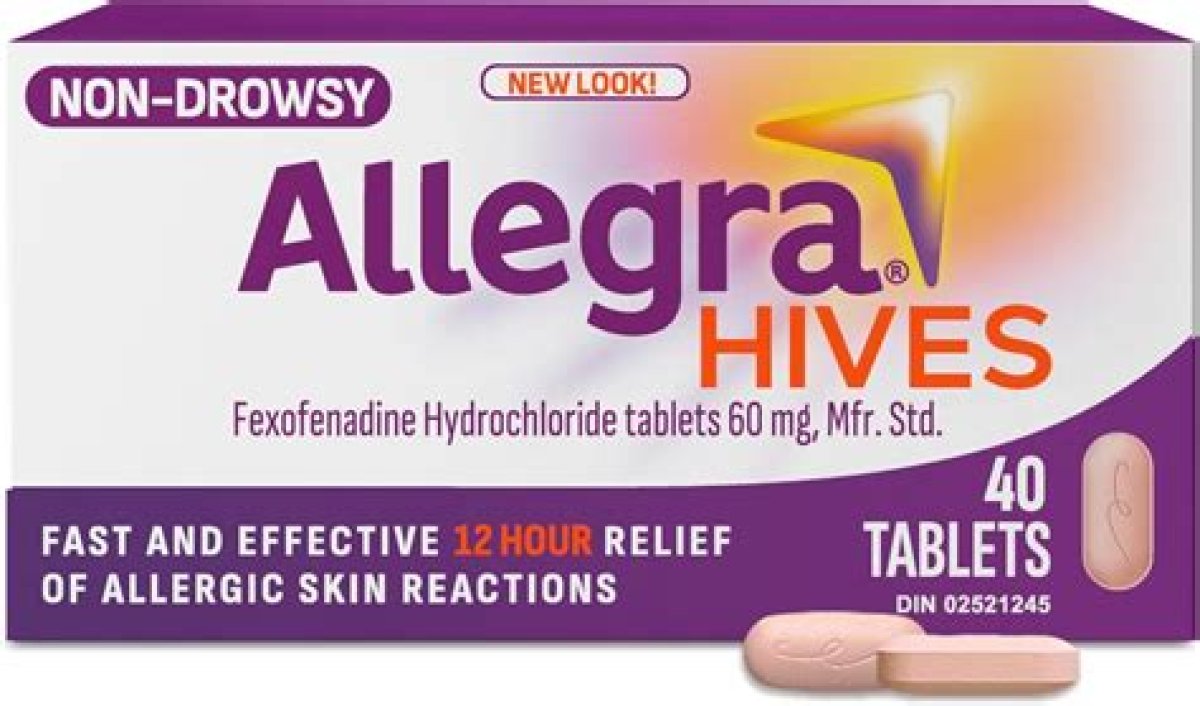 Is Allegra Good for Itchy Skin?