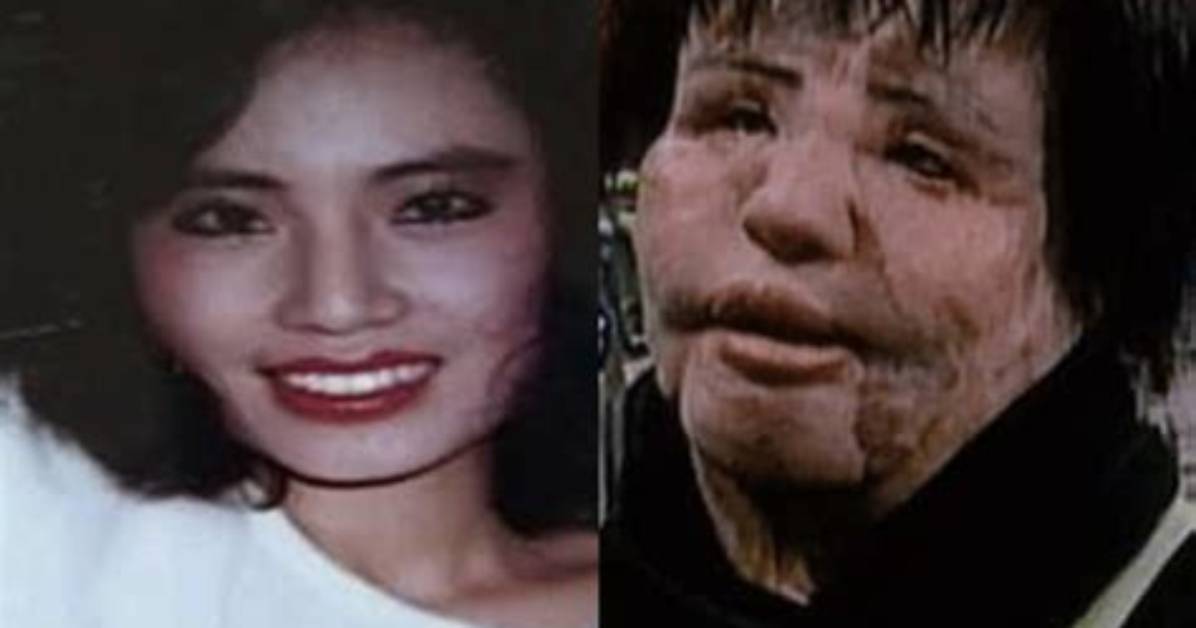 Is Hang Mioku Alive? Her Plastic Surgery Addiction Discussed