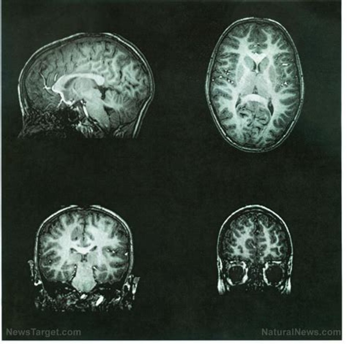 Kentucky Health | Infections of the Brain and Nervous System | Season 16 | Episode 17