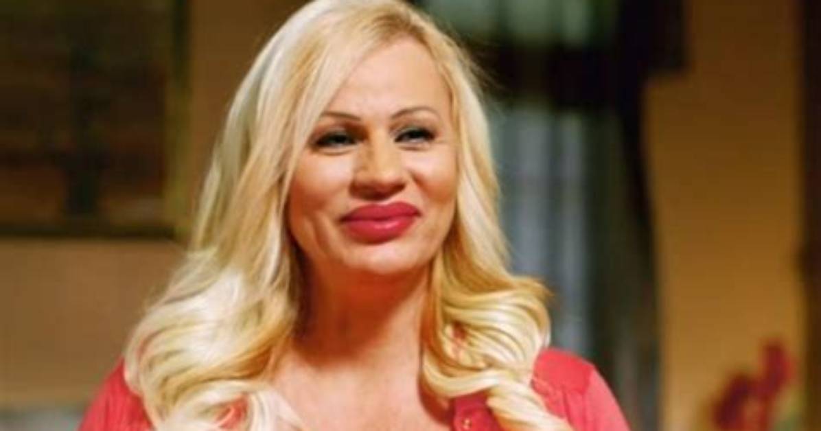 Lacey Wildd Before & After Plastic Surgery