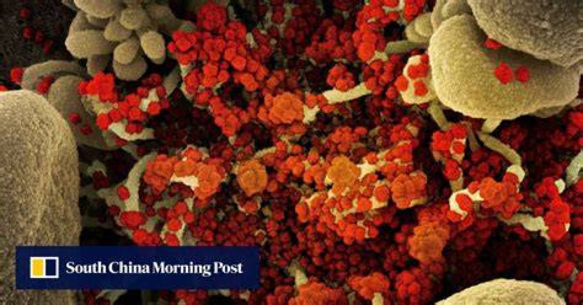 Man Had Rare Covid Infection That Lasted 613 Days, Showed Extensive Mutations