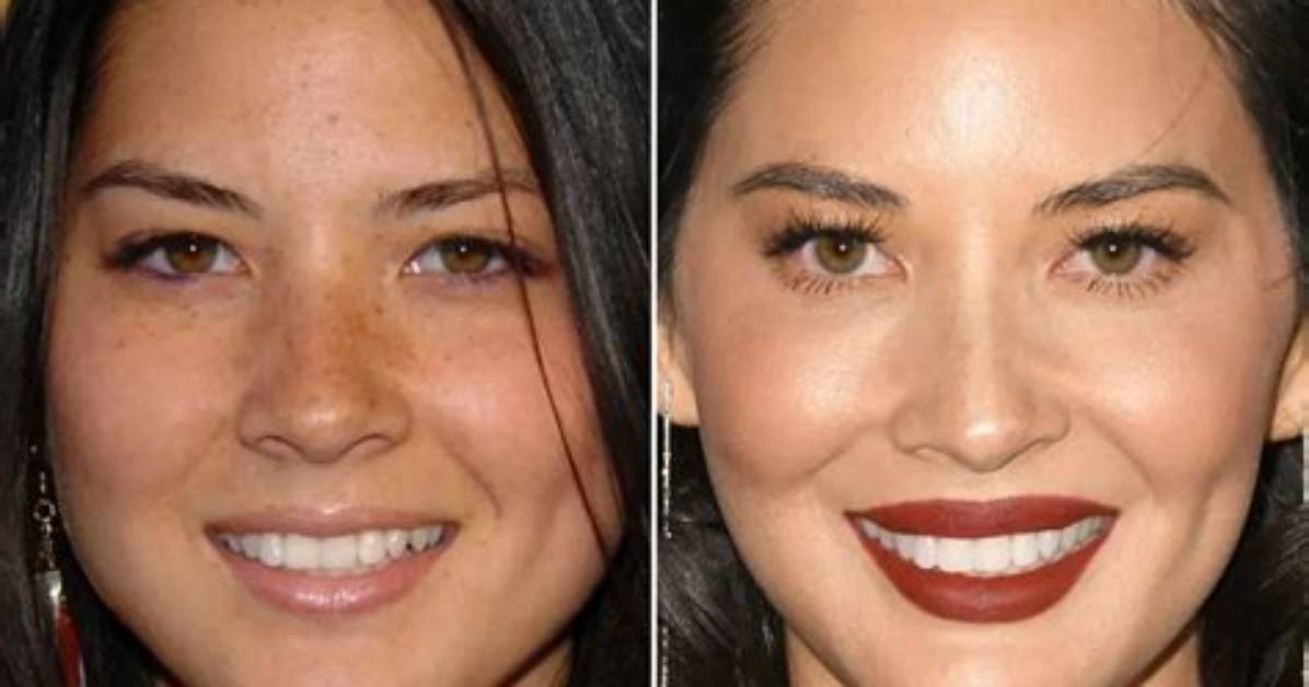 Olivia Munn's Transformation Sparks Plastic Surgery Rumors