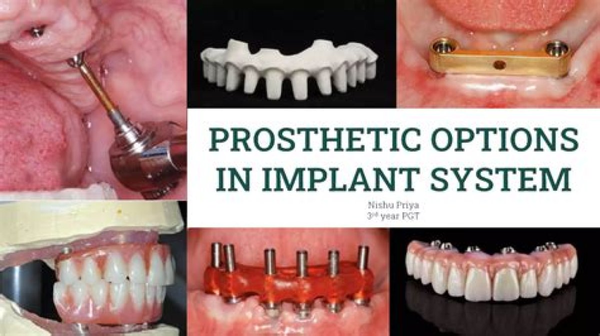 The Face of Prosthetic Dentistry