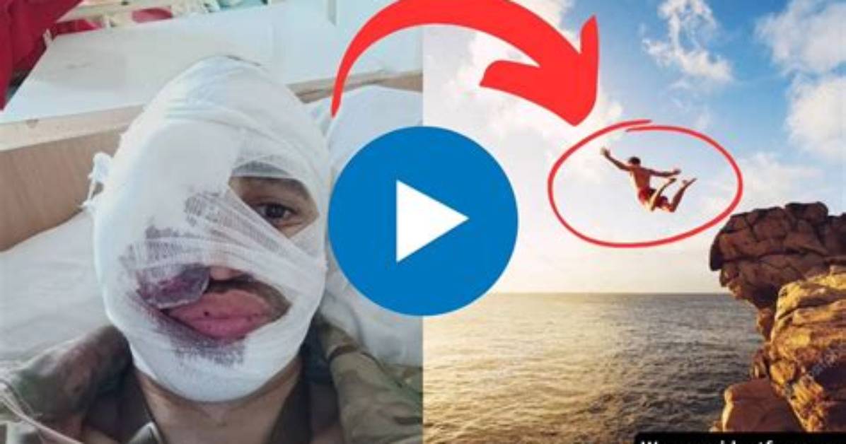 Tiktok's 'Face Split' Diving Accident Is a Trend You Need to Avoid