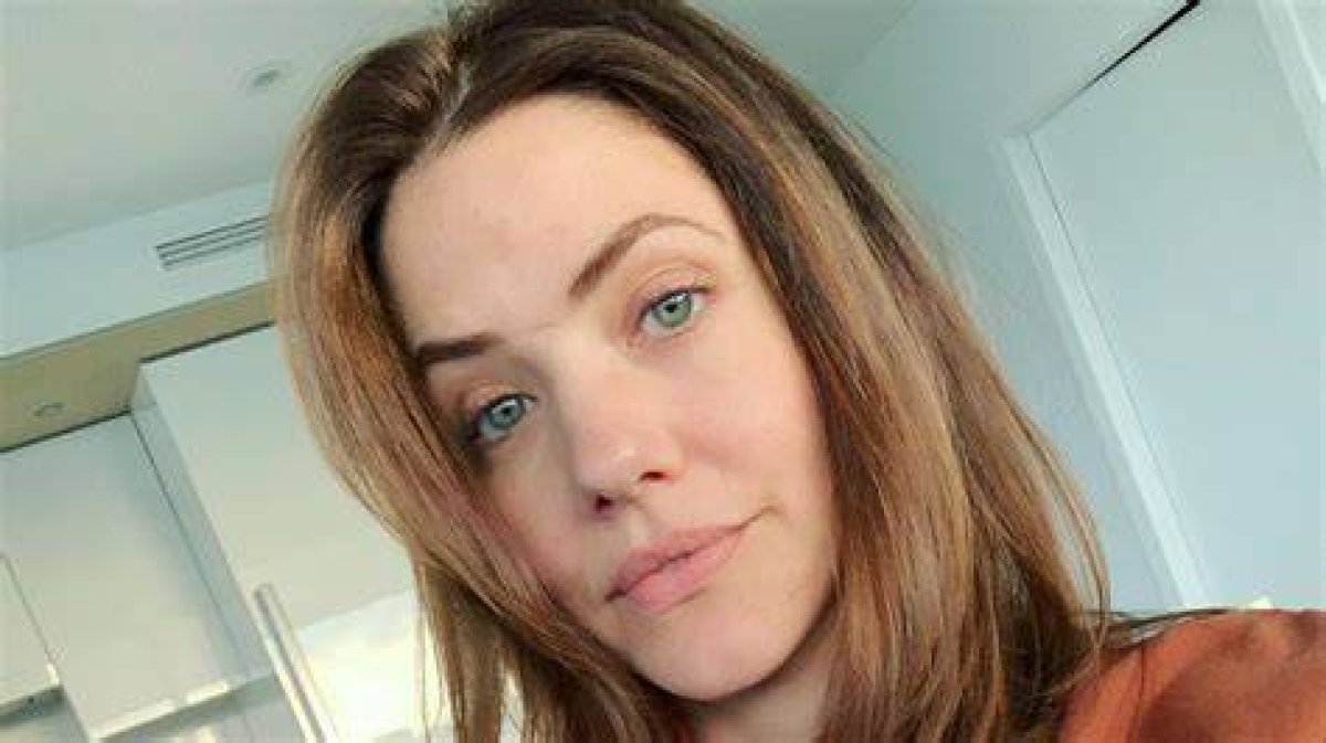 Understanding Julie Gonzalo's Scar: a Journey Through Resilience and Beauty