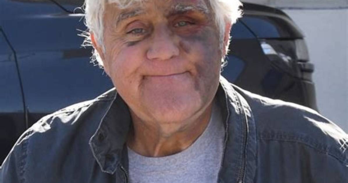Understanding the Jay Leno Death Hoax: Facts and Fiction