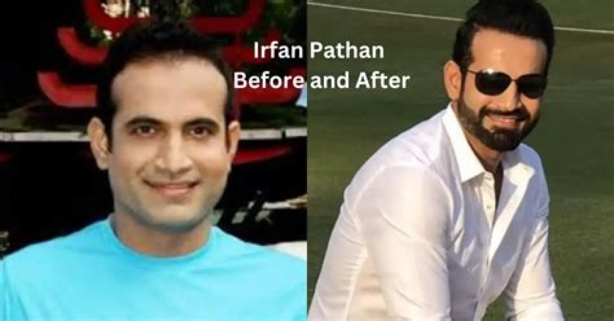 Unlock the Secrets of Irfan Pathan's Towering Height: Uncover Surprising Insights