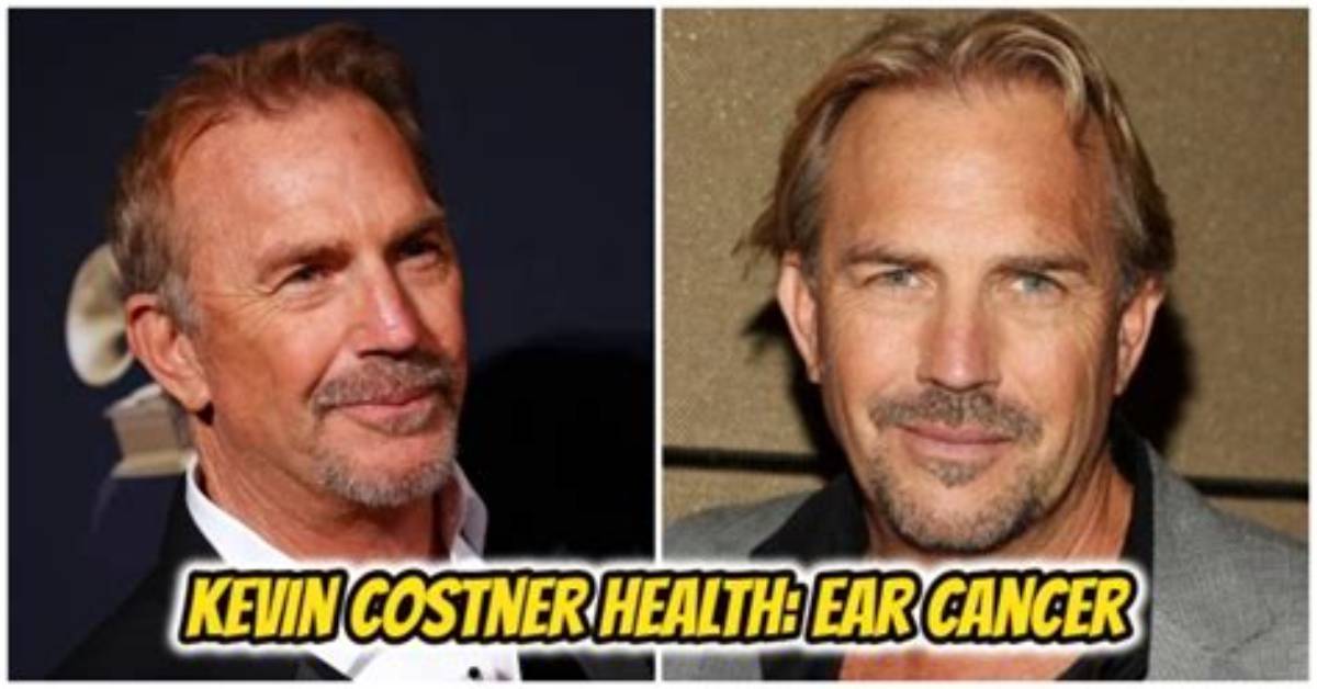 Unlock the Secrets of "Kevin Costner Ear": an Unseen Perspective