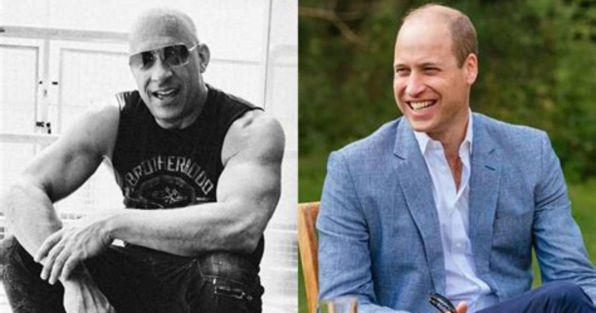 Vin Diesel, Dwayne Johnson, Prince William: Why Bald Is the New Sexy, Despite Ease of Hair Loss Treatments