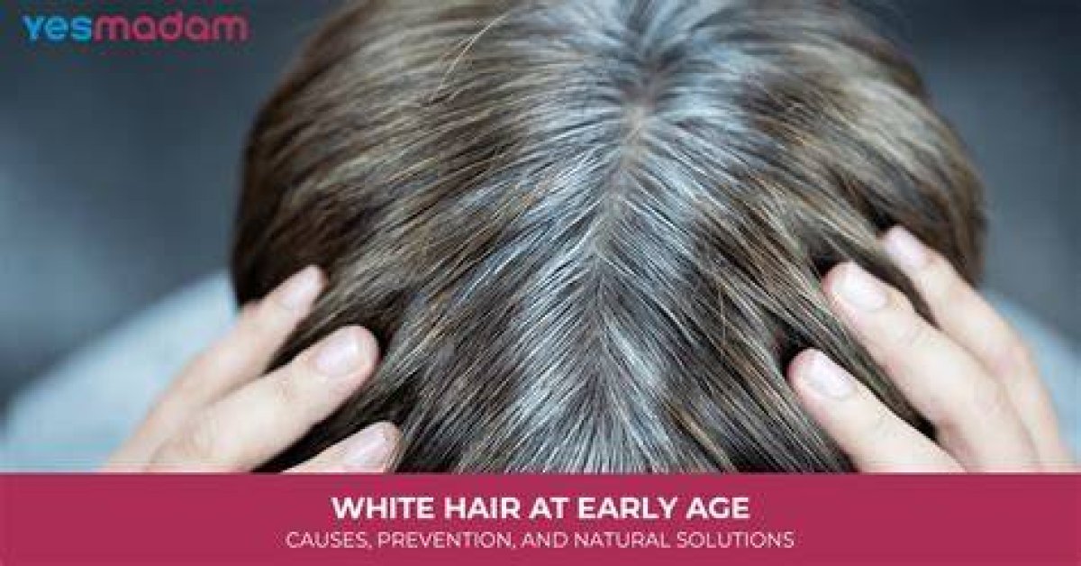 What Age Does White Hair Start?