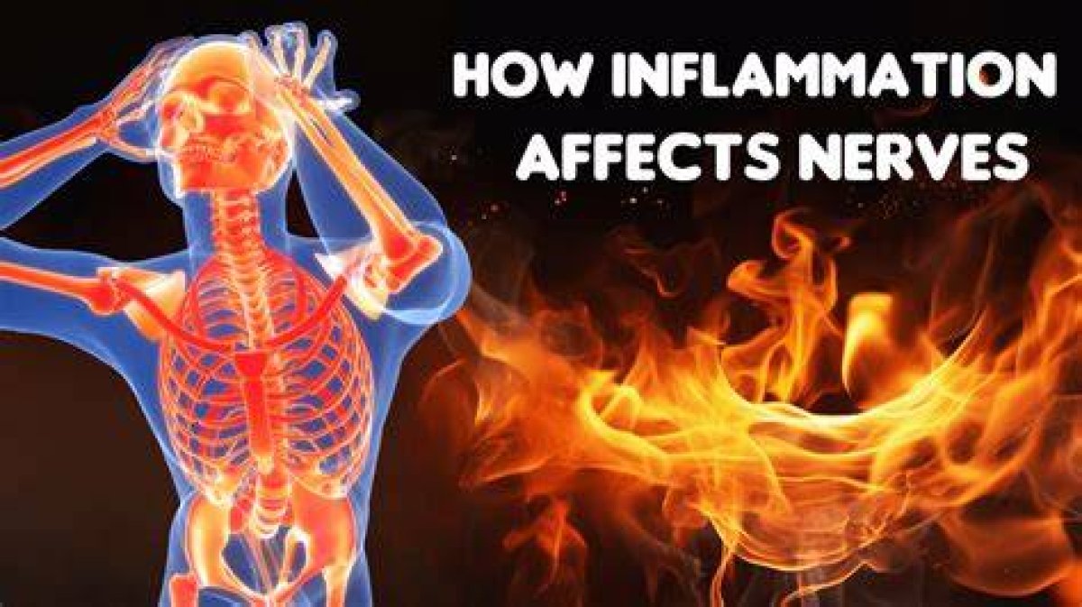 What Are the Symptoms of Nerve Inflammation?