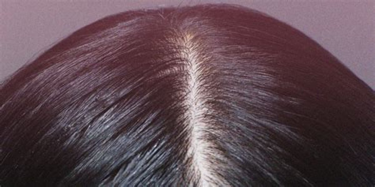 What Color Is Healthy Scalp?