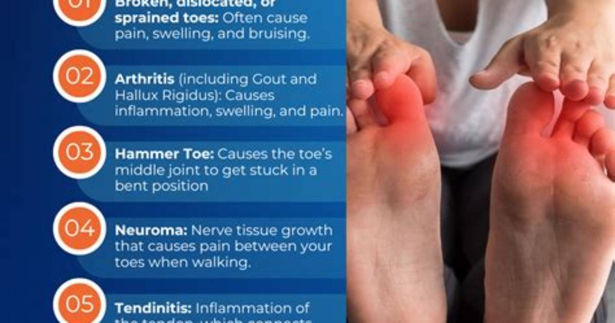 Why Do Your Toes Hurt? the Causes of Bunions and What Can Be Done to Treat Your Feet