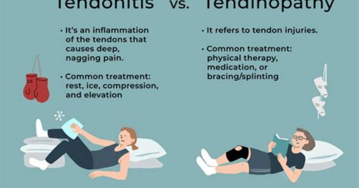 Why Does Tendonitis Hurt So Much?